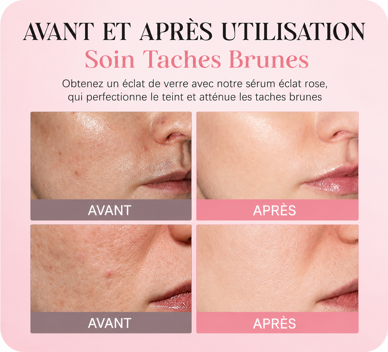 PDRN Rose — Sérum Éclat Peptidique