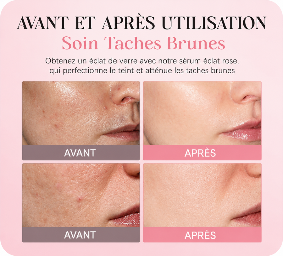 PDRN Rose — Sérum Éclat Peptidique